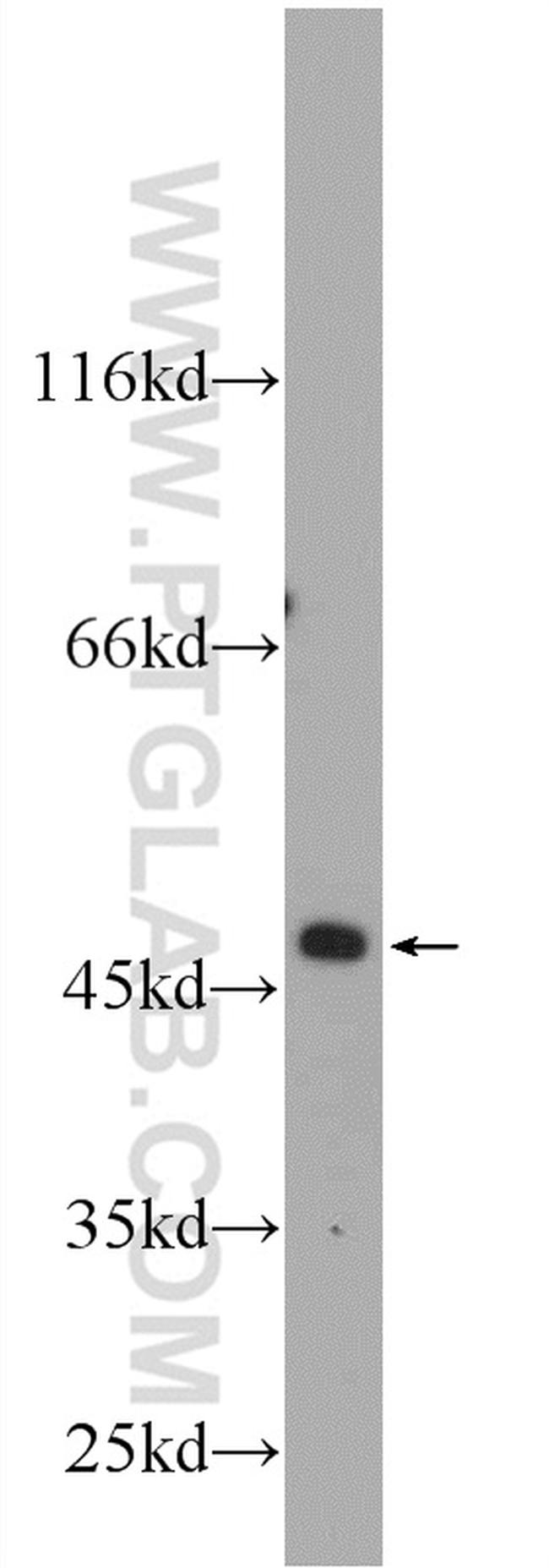 ZNF557 Antibody in Western Blot (WB)