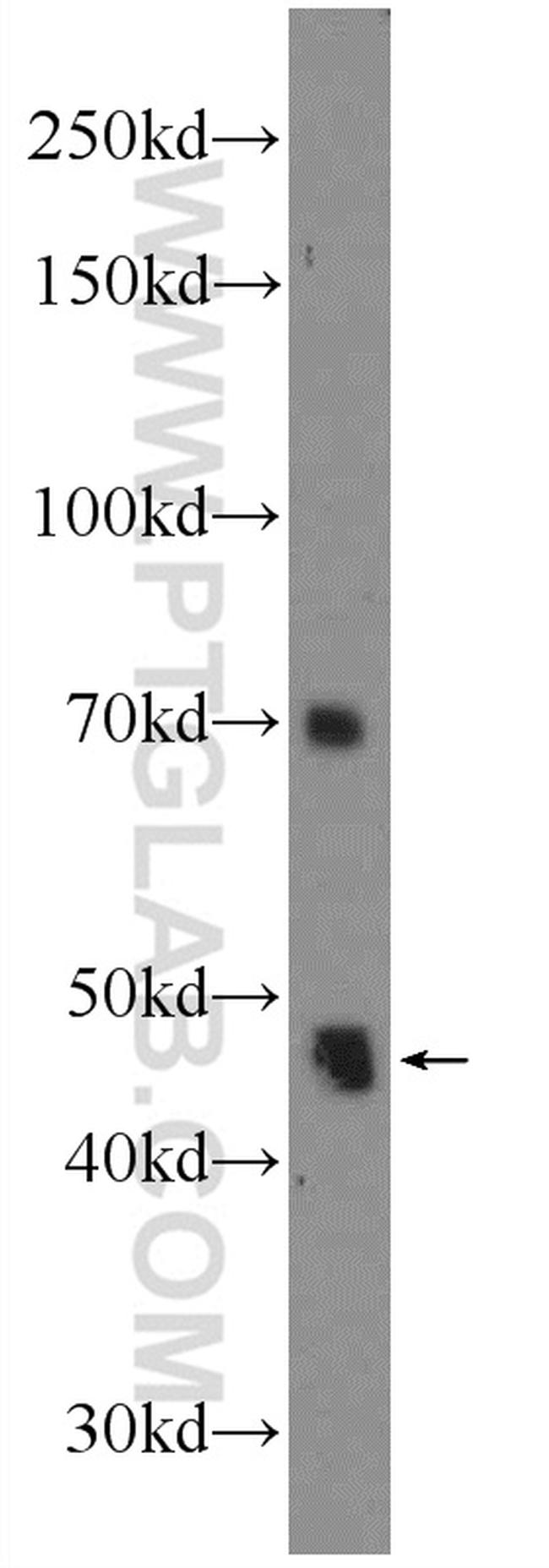 ZNF557 Antibody in Western Blot (WB)