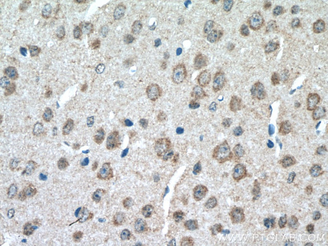 SLC11A2 Antibody in Immunohistochemistry (Paraffin) (IHC (P))