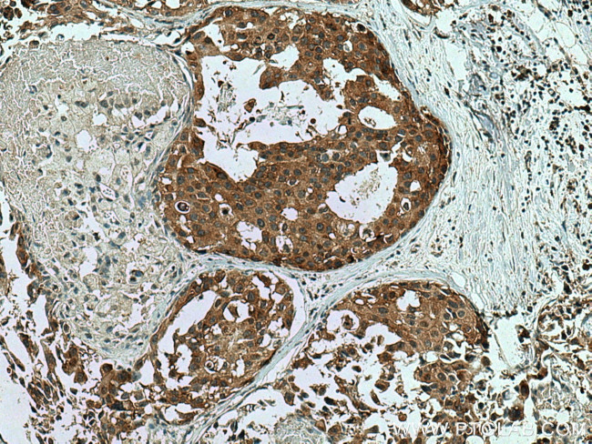 WIPF2 Antibody in Immunohistochemistry (Paraffin) (IHC (P))