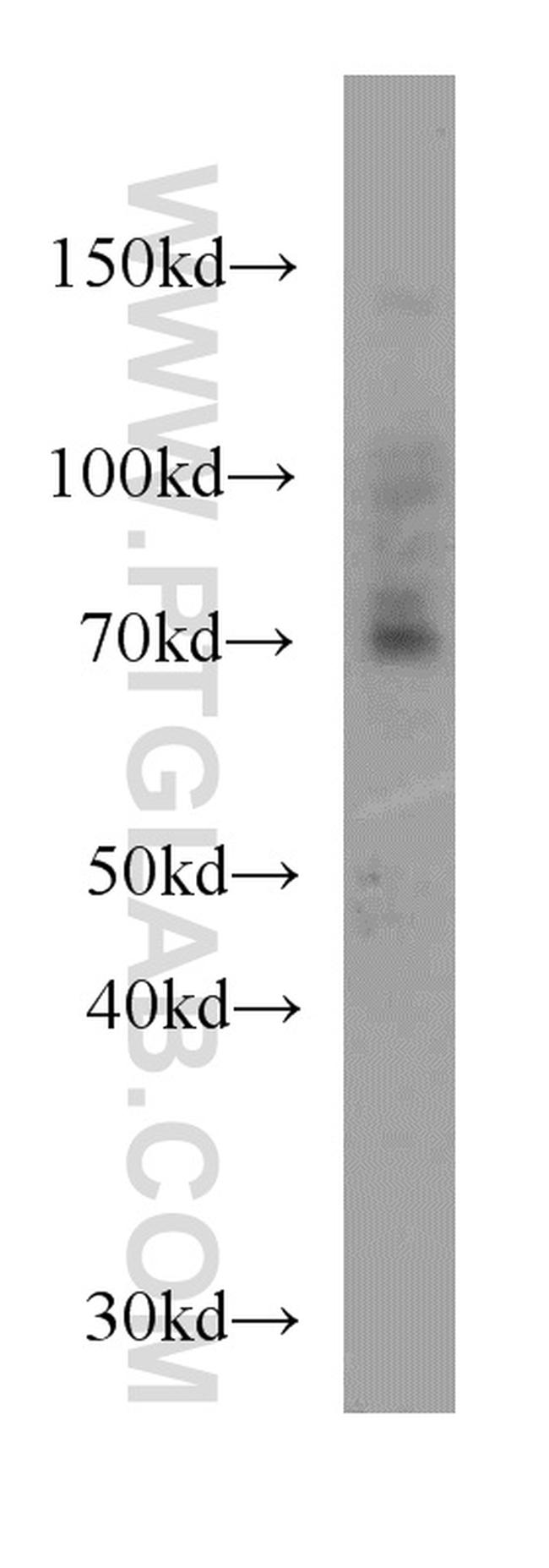 ZXDC Antibody in Western Blot (WB)