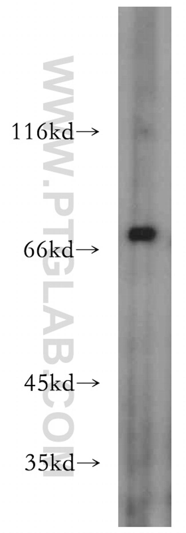 ZXDC Polyclonal Antibody (20530-1-AP)