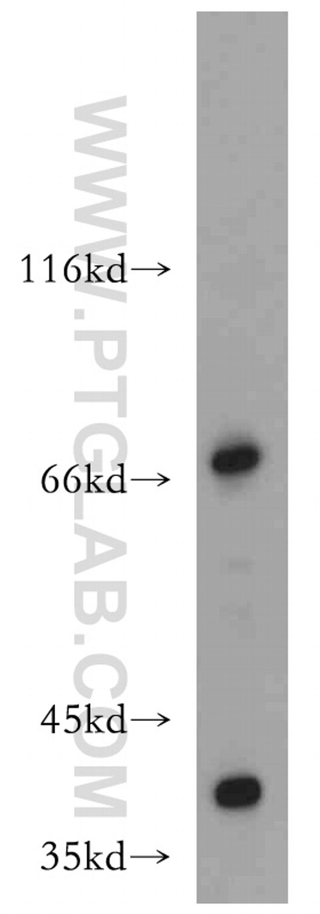 ZXDC Antibody in Western Blot (WB)