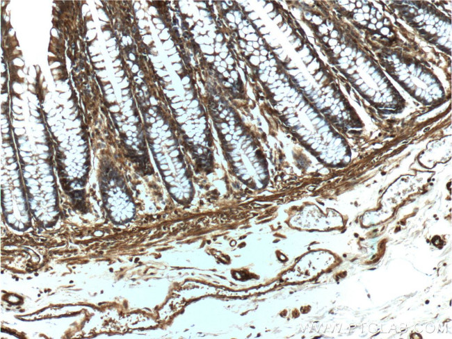 beta Actin Antibody in Immunohistochemistry (Paraffin) (IHC (P))