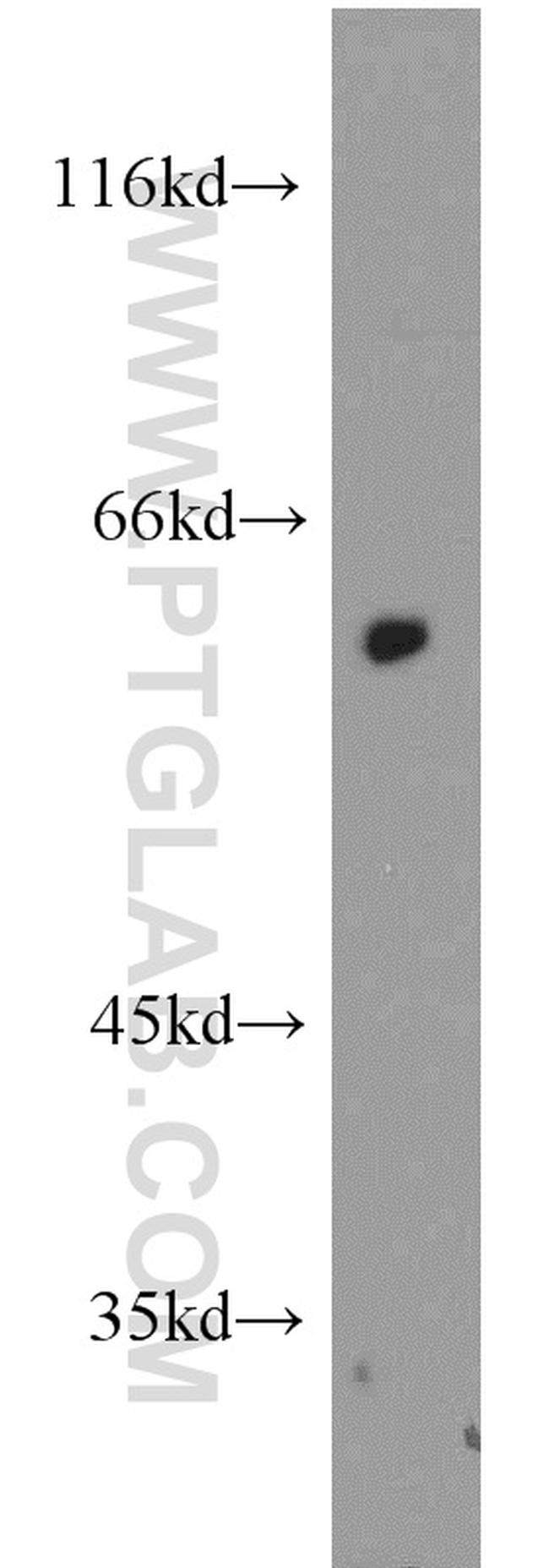 PAX7 Antibody in Western Blot (WB)