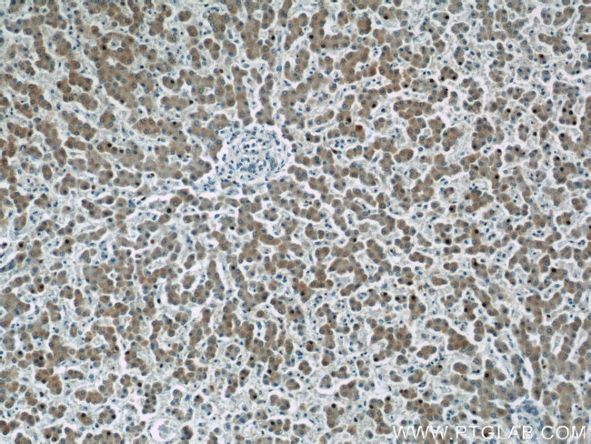 APOB Antibody in Immunohistochemistry (Paraffin) (IHC (P))