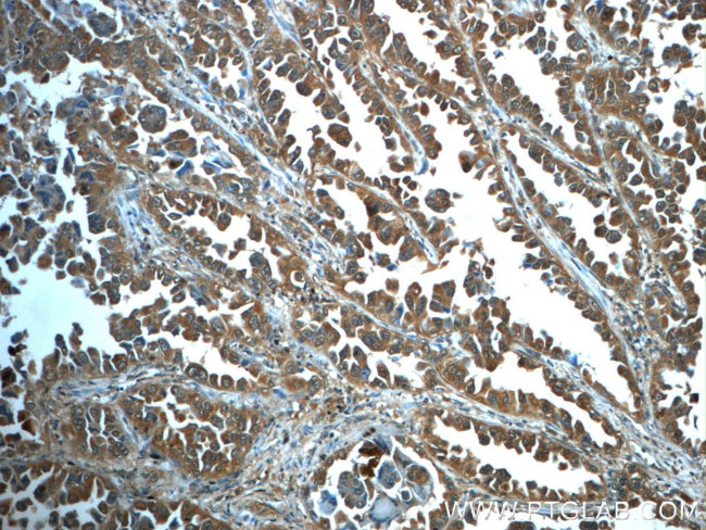 PI3K p110(beta) Antibody in Immunohistochemistry (Paraffin) (IHC (P))