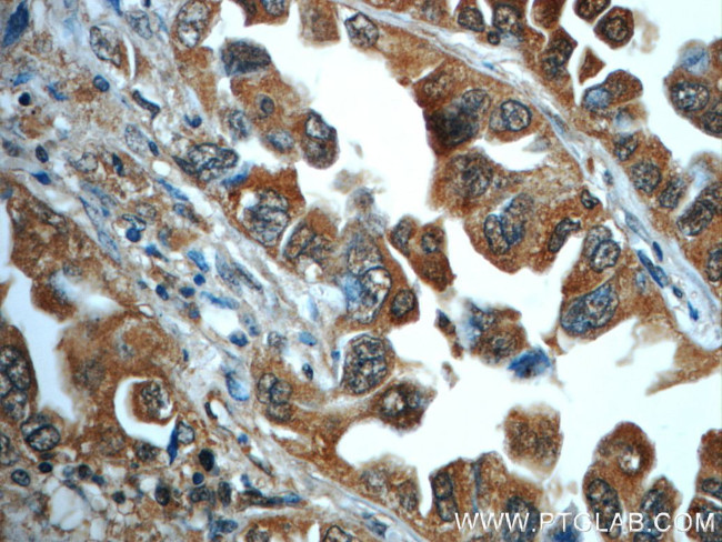 PI3K p110(beta) Antibody in Immunohistochemistry (Paraffin) (IHC (P))