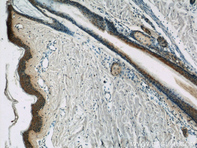 PI3K p110(beta) Antibody in Immunohistochemistry (Paraffin) (IHC (P))