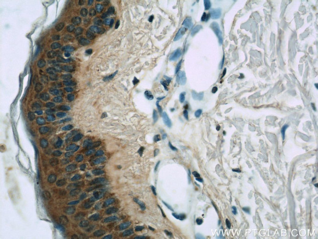 PI3K p110(beta) Antibody in Immunohistochemistry (Paraffin) (IHC (P))