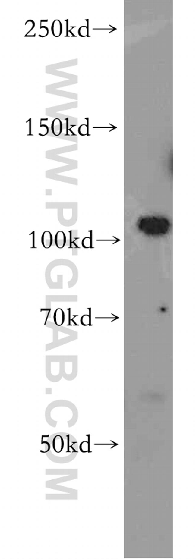 PI3K p110(beta) Antibody in Western Blot (WB)