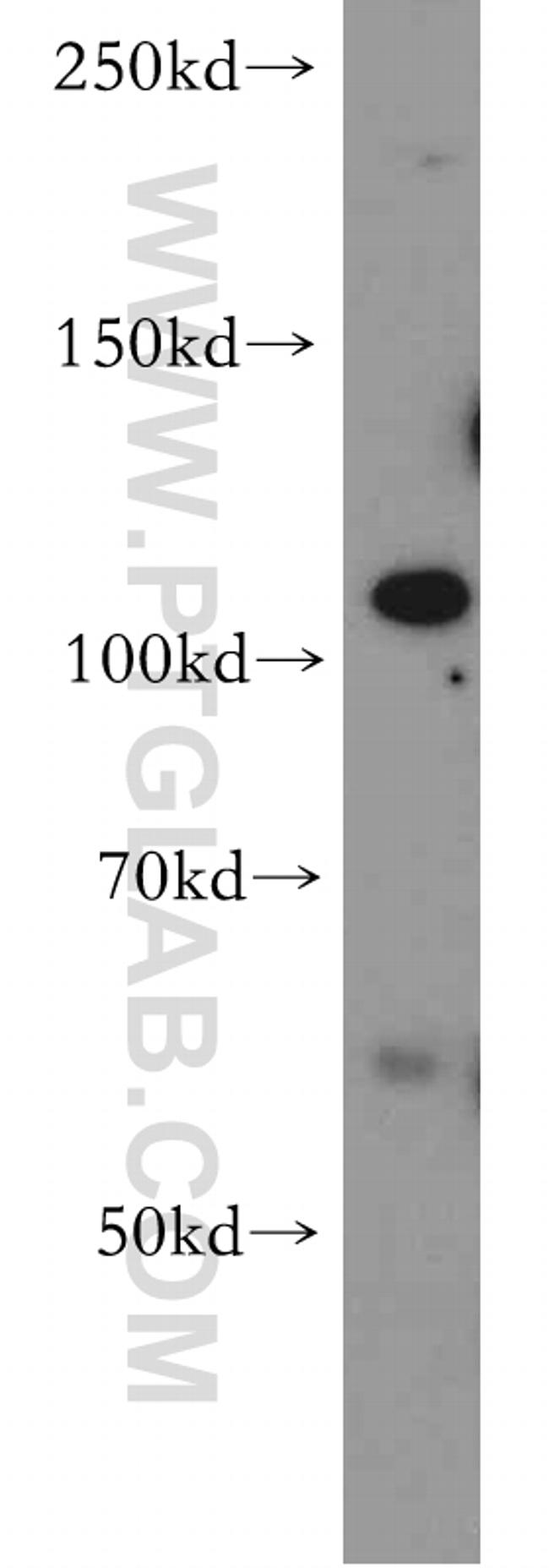 PI3K p110(beta) Antibody in Western Blot (WB)