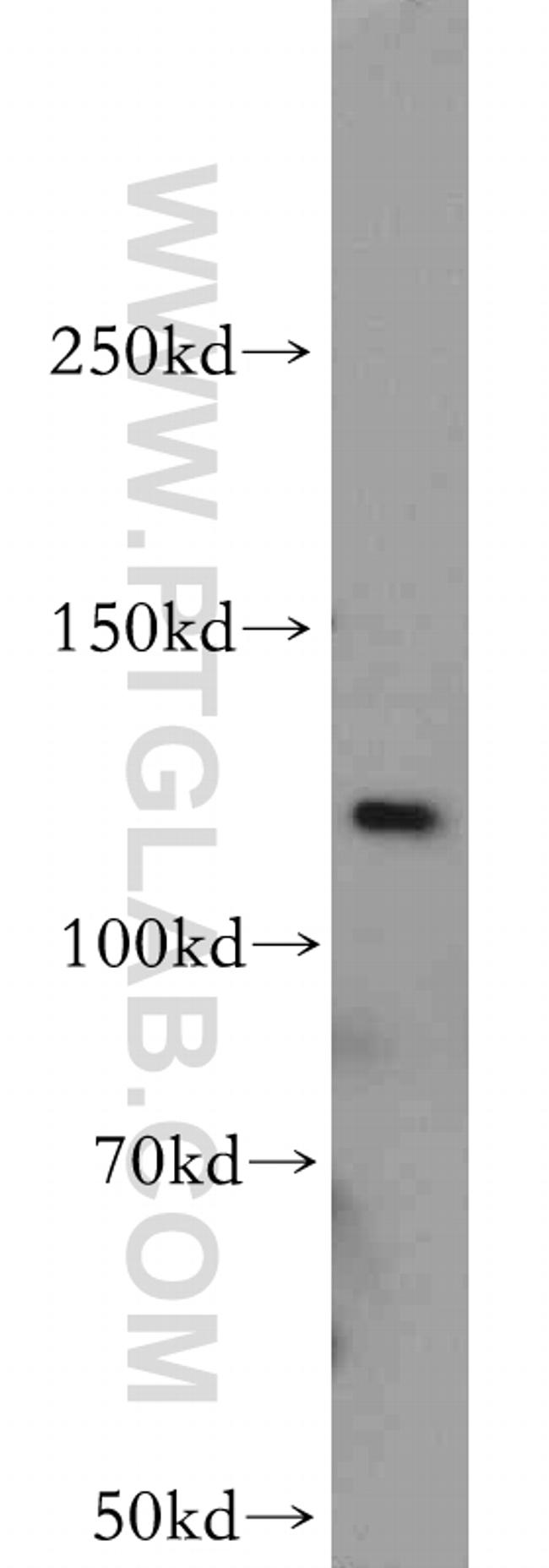 PI3K p110(beta) Antibody in Western Blot (WB)