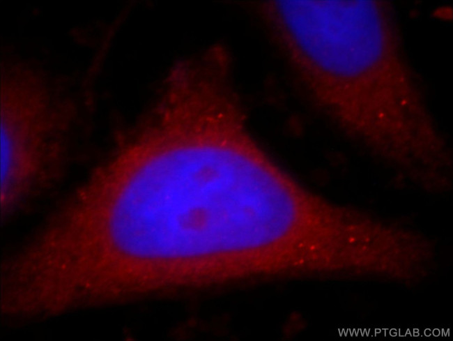 PI3K p110(beta) Antibody in Immunocytochemistry (ICC/IF)