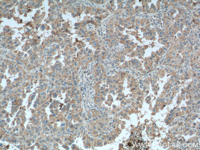 PI3K p110(beta) Antibody in Immunohistochemistry (Paraffin) (IHC (P))