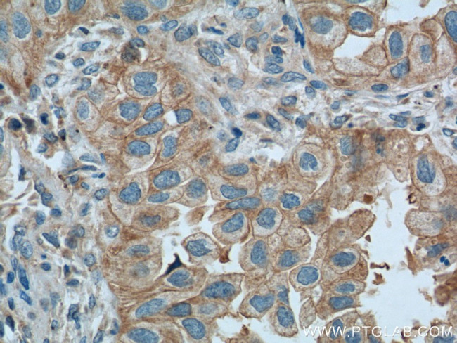 PI3K p110(beta) Antibody in Immunohistochemistry (Paraffin) (IHC (P))