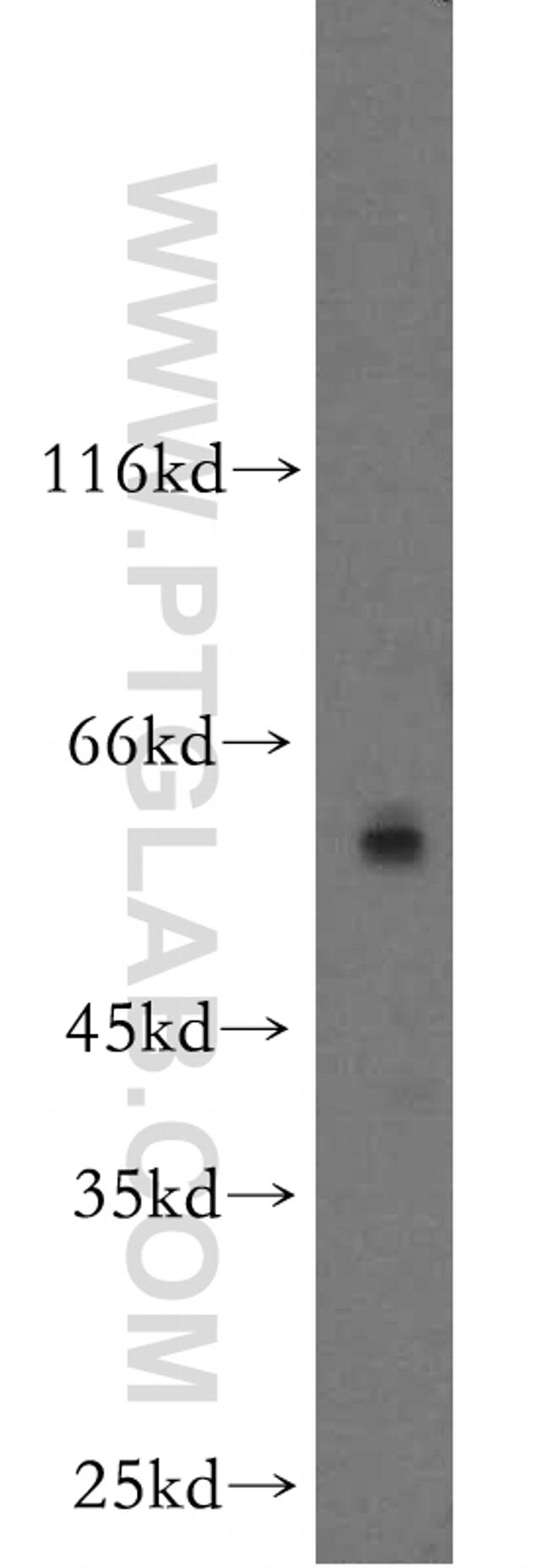 ZIP4 Antibody in Western Blot (WB)