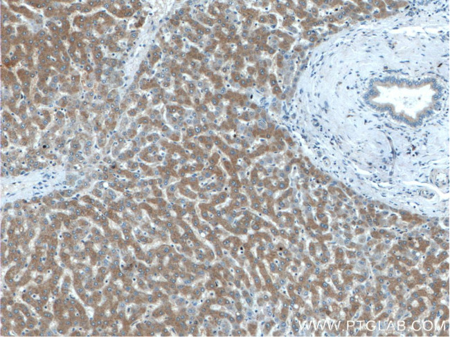 IIP45 Antibody in Immunohistochemistry (Paraffin) (IHC (P))