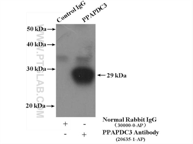 PPAPDC3 Antibody in Immunoprecipitation (IP)