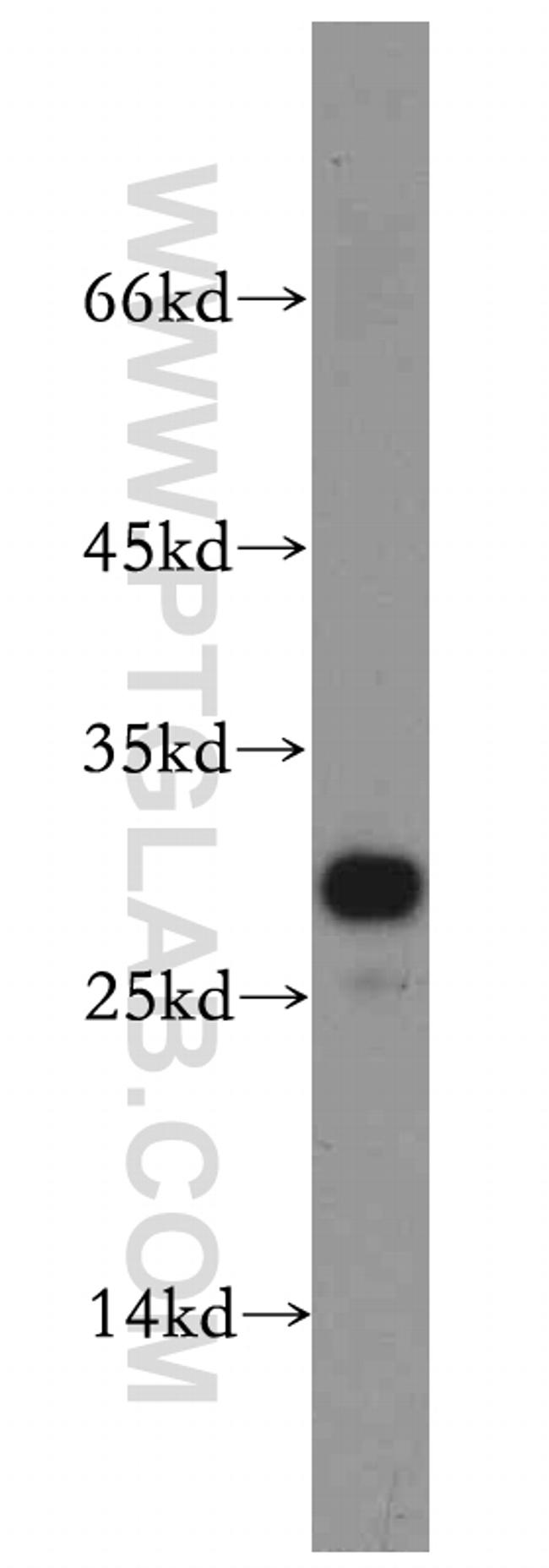 PPAPDC3 Antibody in Western Blot (WB)