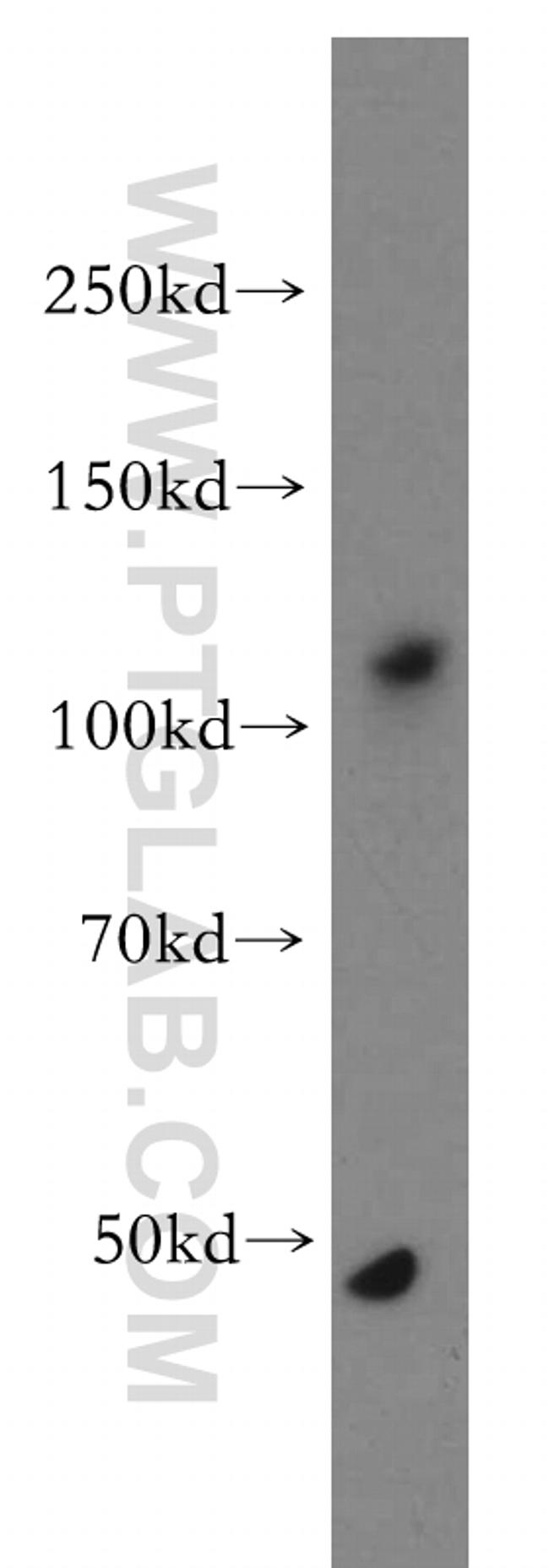 ANO2 Antibody in Western Blot (WB)