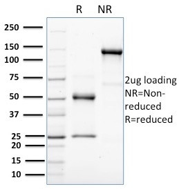 HER-4/ERBB4 Antibody in SDS-PAGE (SDS-PAGE)