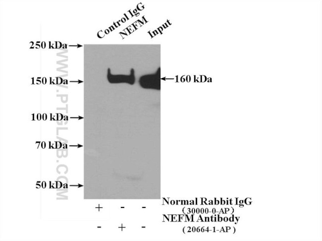 NF-M Antibody in Immunoprecipitation (IP)