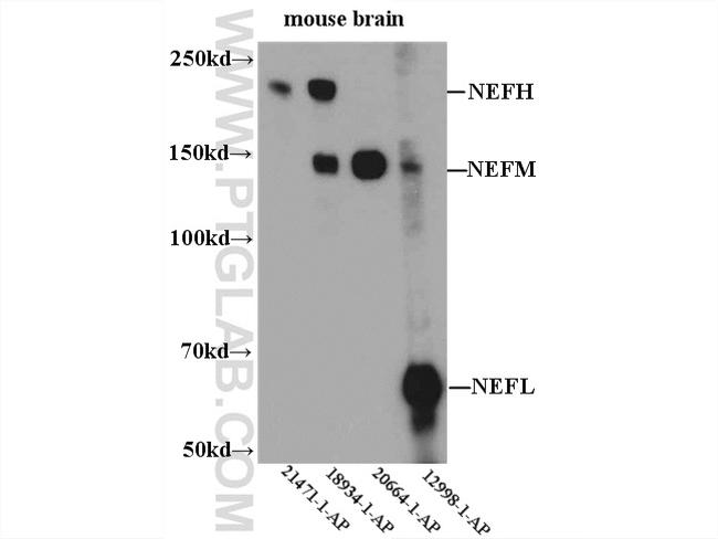 NF-M Antibody in Western Blot (WB)