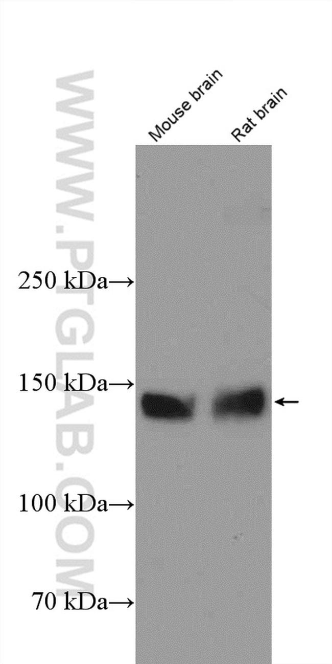 NF-M Antibody in Western Blot (WB)