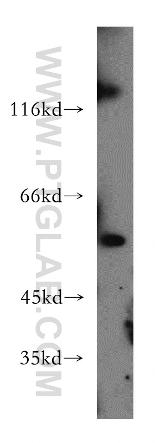 SLC16A2 Antibody in Western Blot (WB)