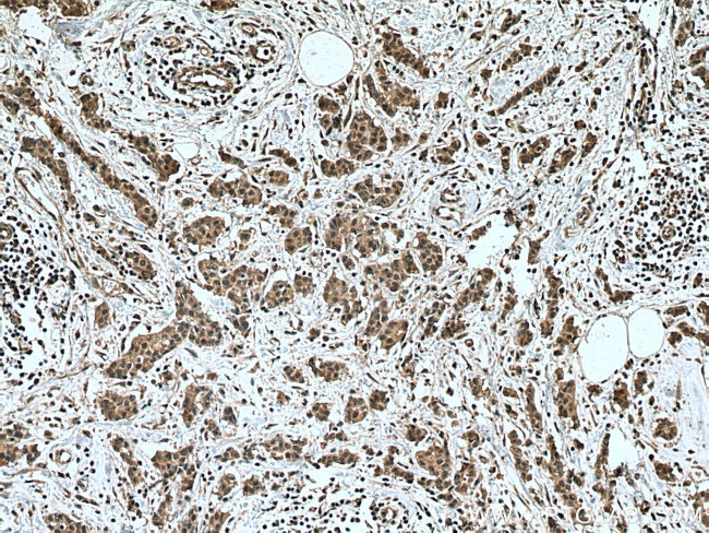 NOTCH1 Antibody in Immunohistochemistry (Paraffin) (IHC (P))