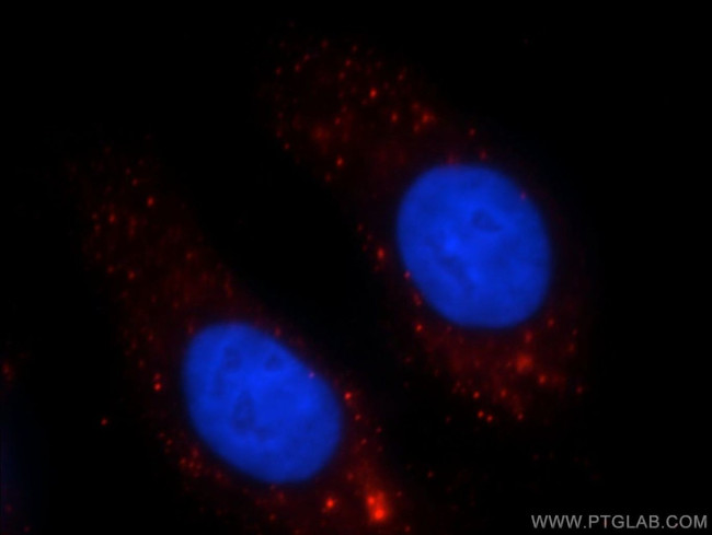 SHH Antibody in Immunocytochemistry (ICC/IF)