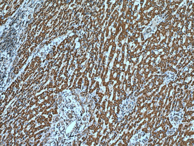 SHH Antibody in Immunohistochemistry (Paraffin) (IHC (P))