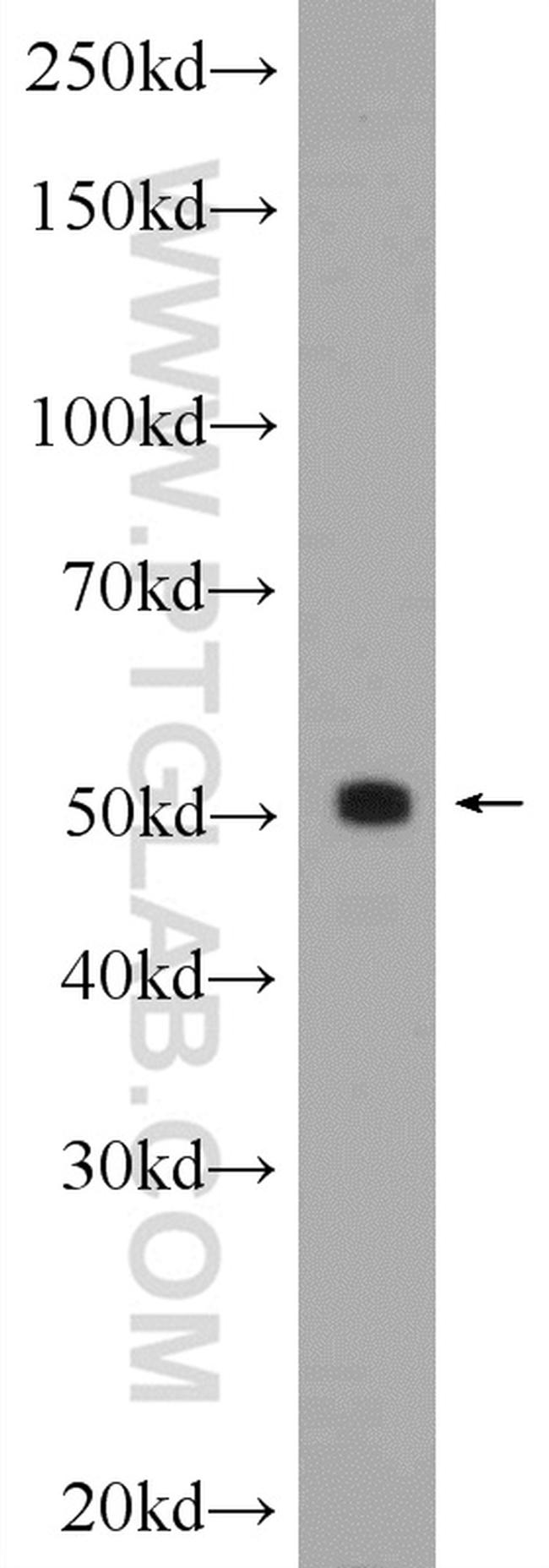 SHH Antibody in Western Blot (WB)