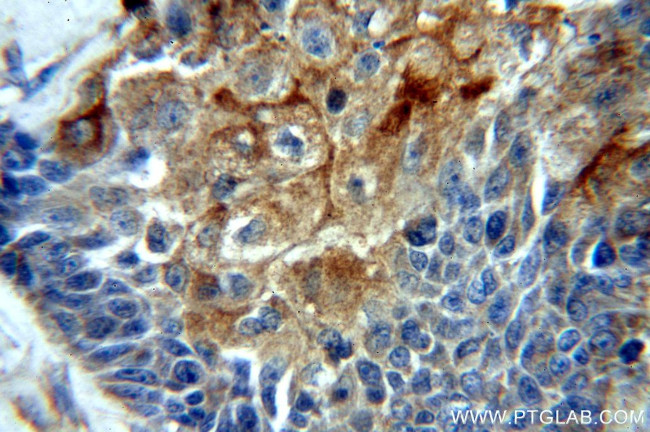 LIMS1 Antibody in Immunohistochemistry (Paraffin) (IHC (P))