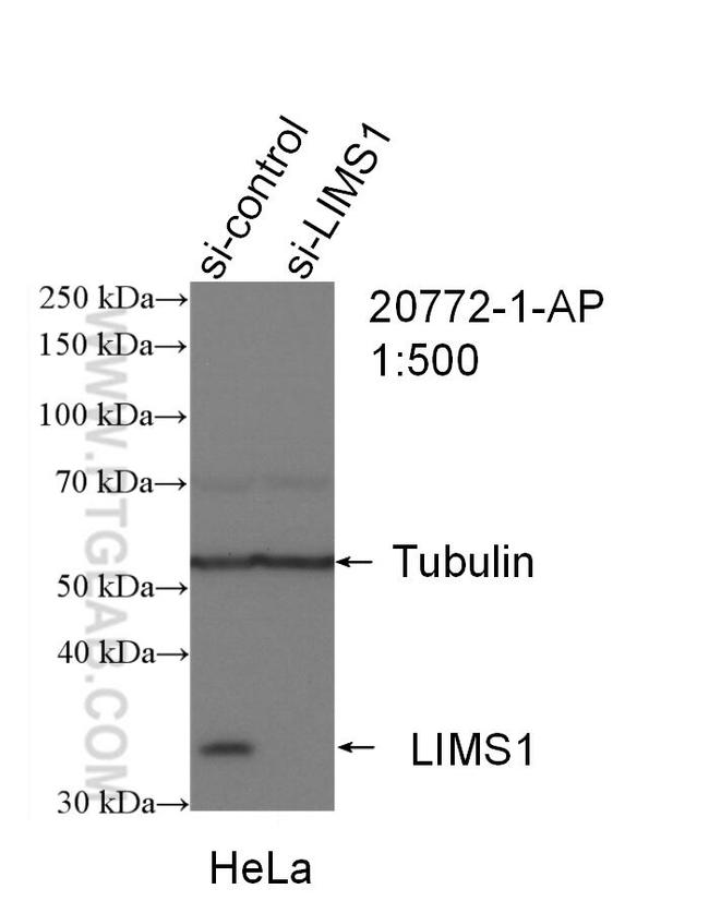 LIMS1 Antibody in Western Blot (WB)
