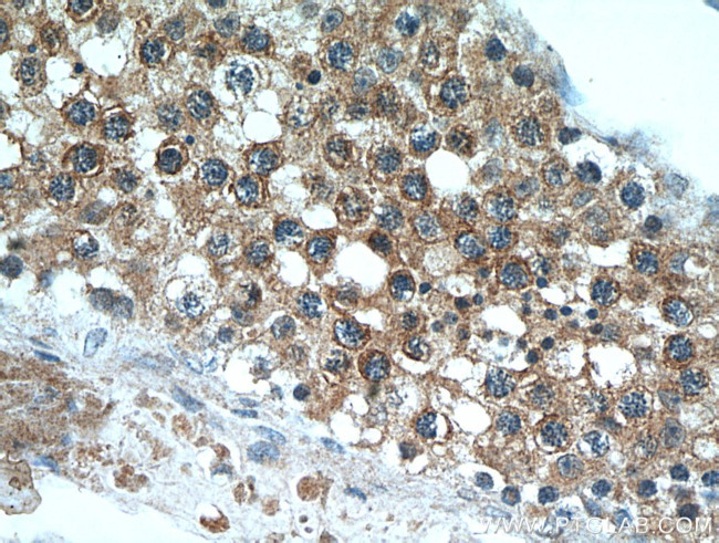 C11orf70 Antibody in Immunohistochemistry (Paraffin) (IHC (P))