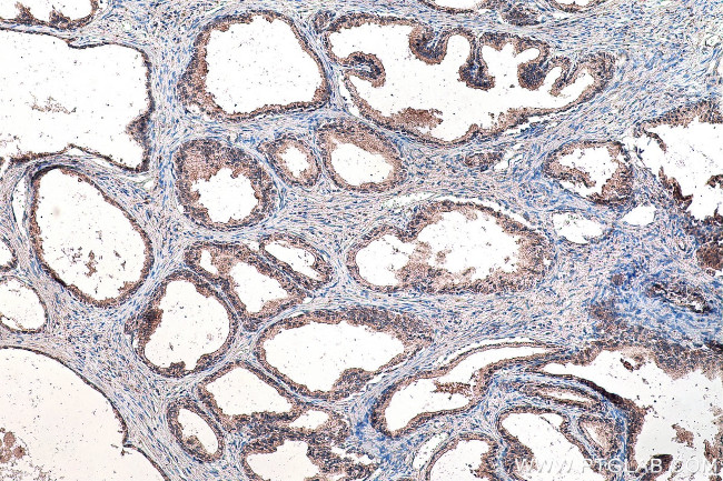 SMO Antibody in Immunohistochemistry (Paraffin) (IHC (P))