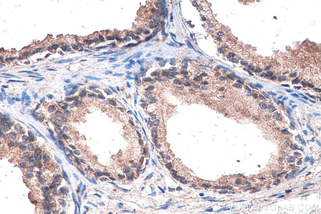 SMO Antibody in Immunohistochemistry (Paraffin) (IHC (P))