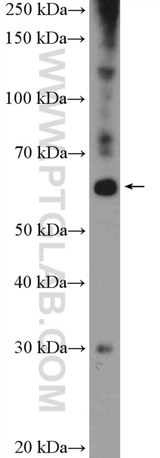 ZNF397 Antibody in Western Blot (WB)