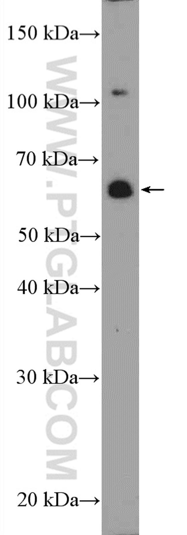 ZNF397 Antibody in Western Blot (WB)