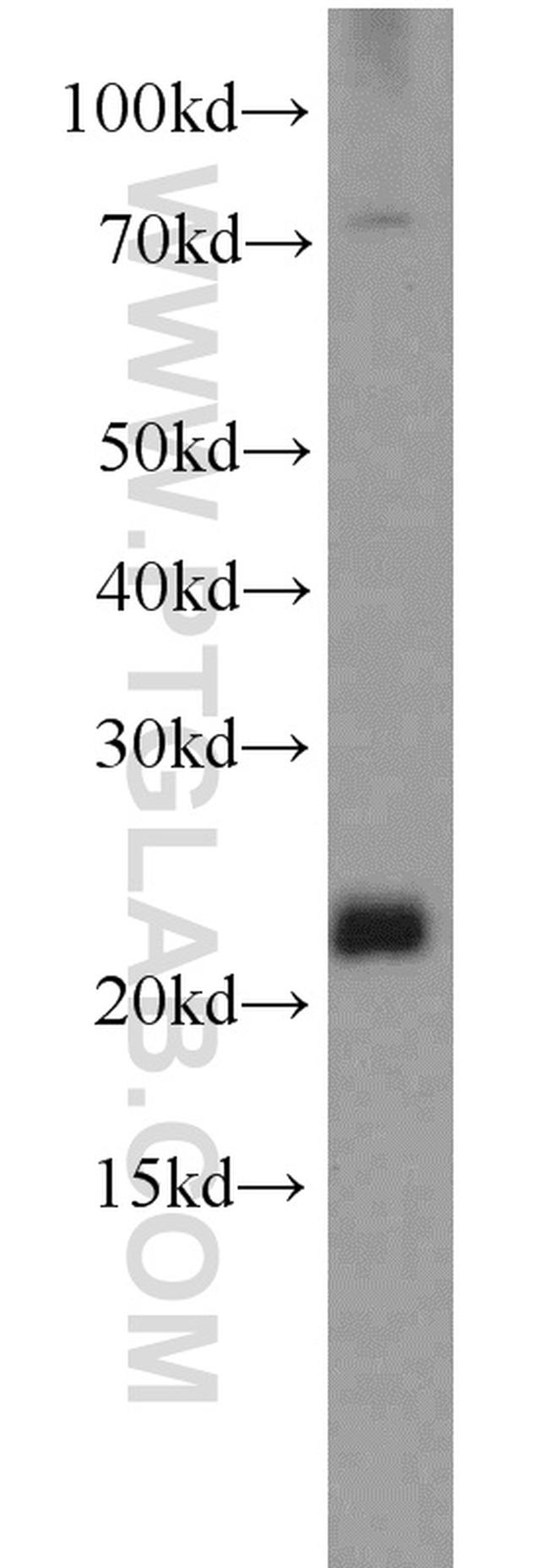 C16orf13 Antibody in Western Blot (WB)