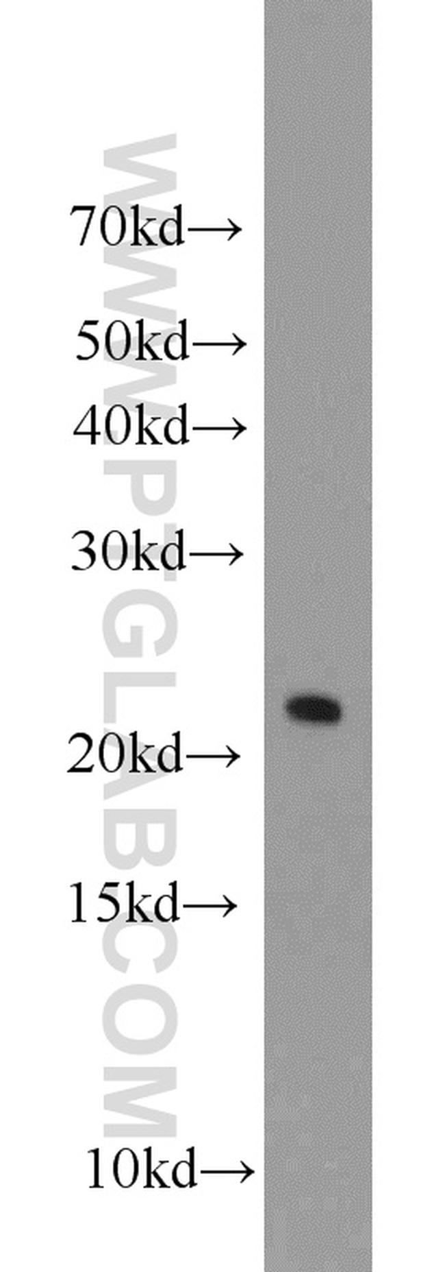 C16orf13 Antibody in Western Blot (WB)