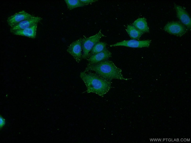 C16orf13 Antibody in Immunocytochemistry (ICC/IF)