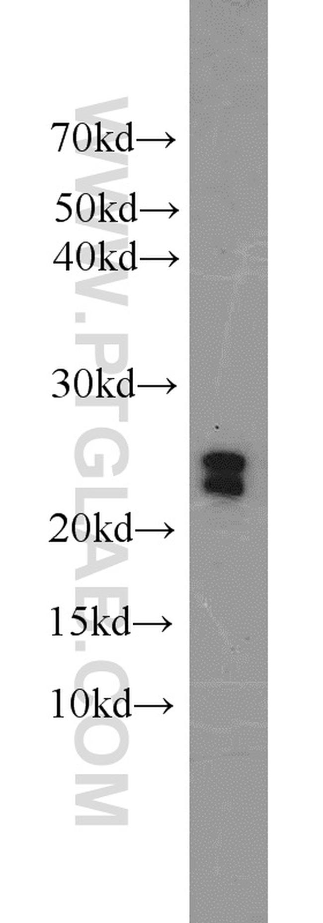 C16orf13 Antibody in Western Blot (WB)