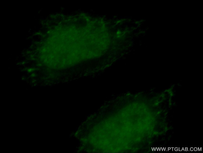 HTATSF1 Antibody in Immunocytochemistry (ICC/IF)