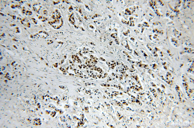 HTATSF1 Antibody in Immunohistochemistry (Paraffin) (IHC (P))