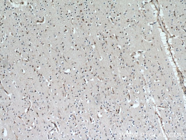 HTATSF1 Antibody in Immunohistochemistry (Paraffin) (IHC (P))