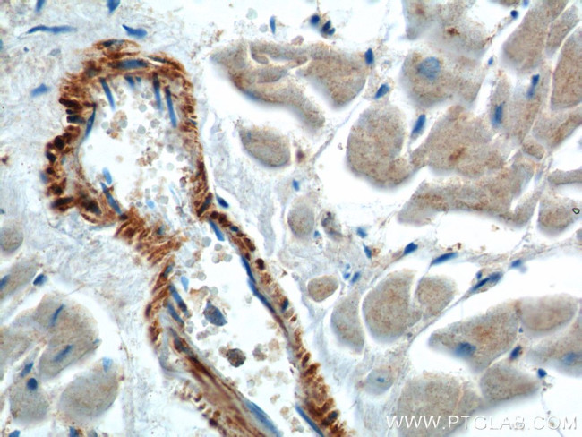 neuron navigator 1 Antibody in Immunohistochemistry (Paraffin) (IHC (P))