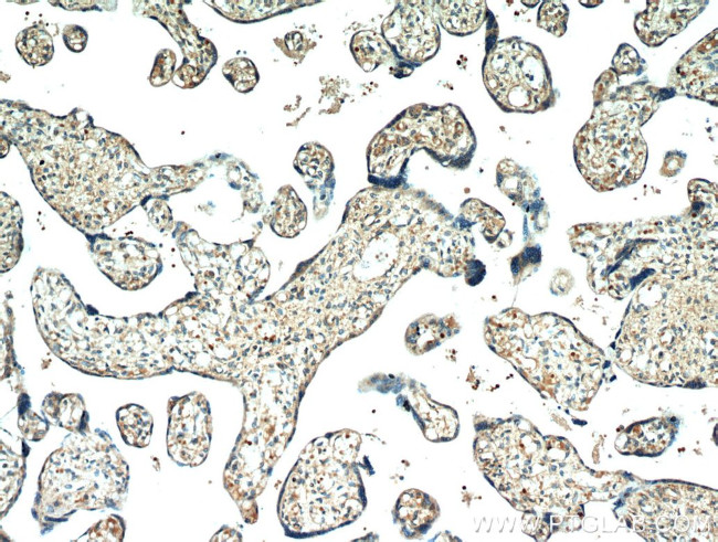 neuron navigator 1 Antibody in Immunohistochemistry (Paraffin) (IHC (P))